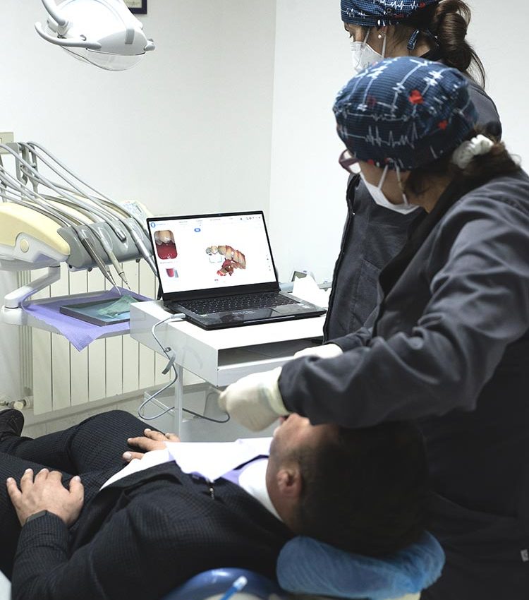 impronta ottica dentale