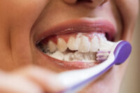 igiene orale denti